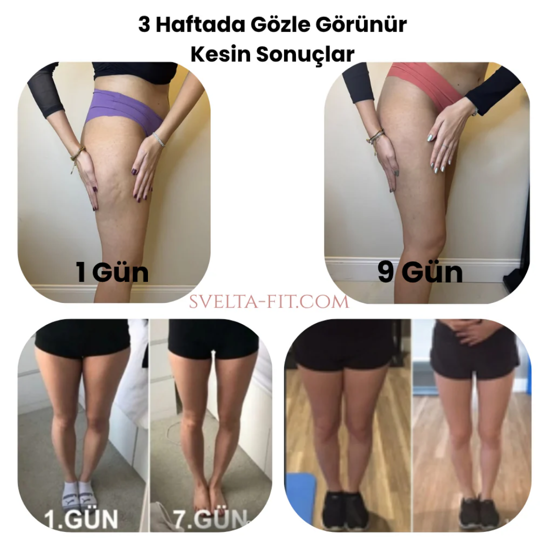 Svelta-Fit® Bacak İncelten Sıkılaştıran Masaj Aleti