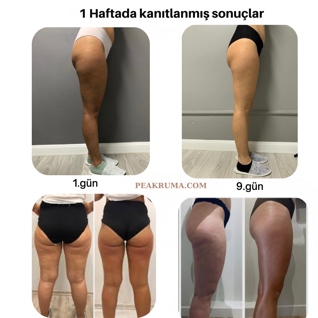 Peakruma® Şekillendirici - Anında Toparlanan Vücut